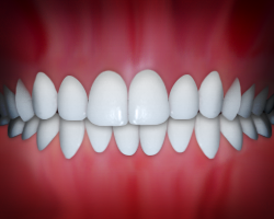 _DentalMidelinesnotMatched